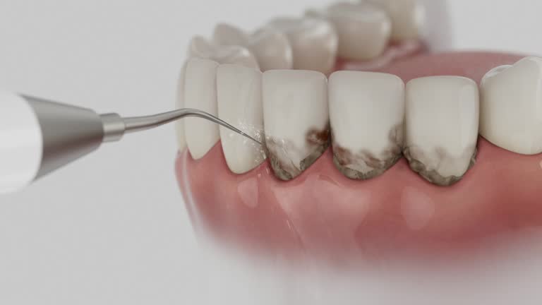Trusted Wisdom Tooth Removal service in Karns, TN - Dentist Open Now